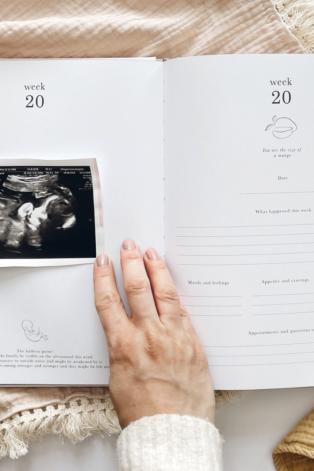 Pregnancy Journal